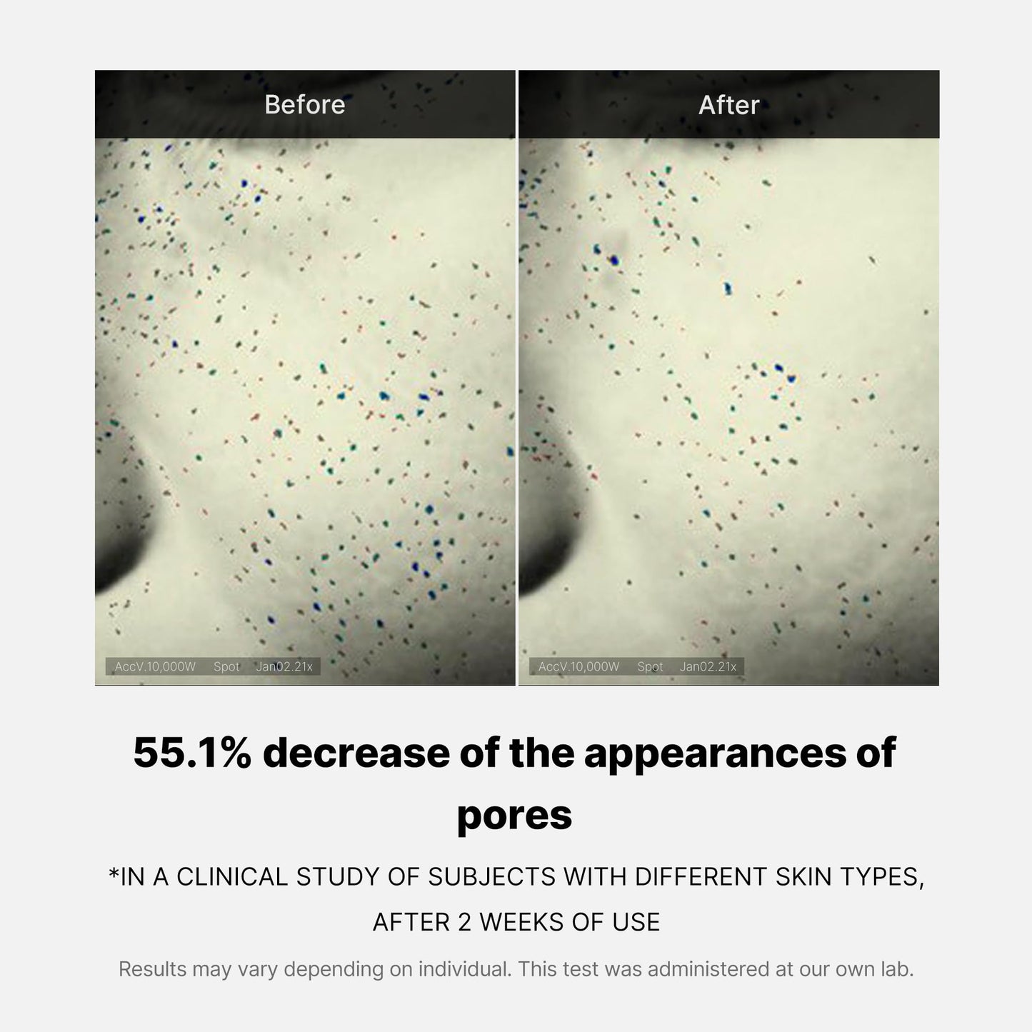 zero-pore-one-day-cream-q8 04_3616addc-f184-4deb-a5d7-e3a782e4713d.jpg
