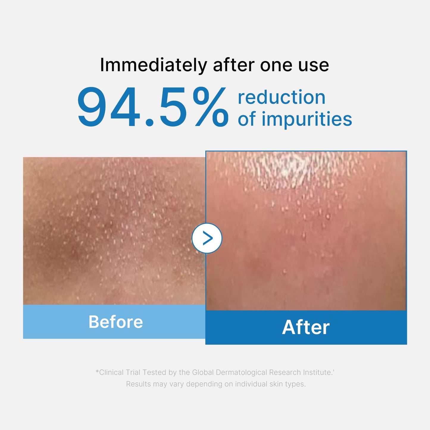zero-pore-blackhead-deep-cleansing-oil-r6 01_eed557ec-5857-46a2-8b17-dbd67c692dcb.jpg