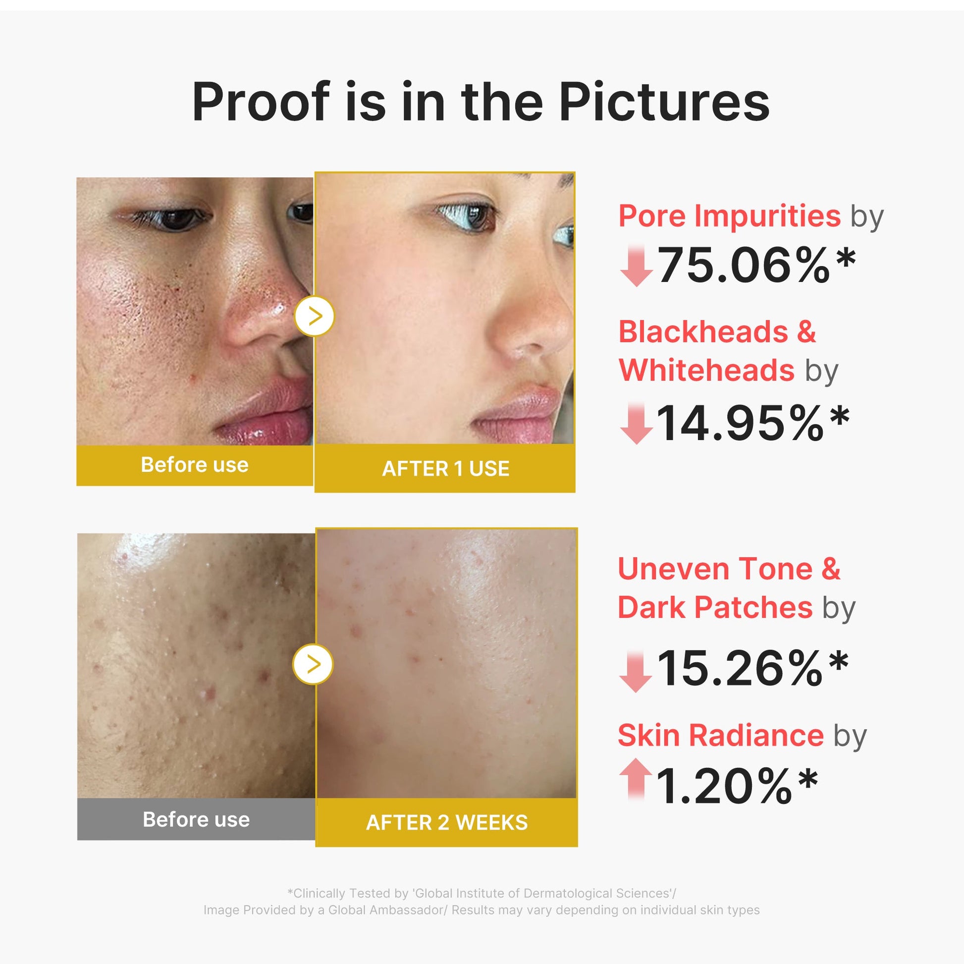 kojic-acid-turmeric-peel-shot-r4 02_45fe66d3-b3f6-4100-aa52-2afd7eded417.jpg