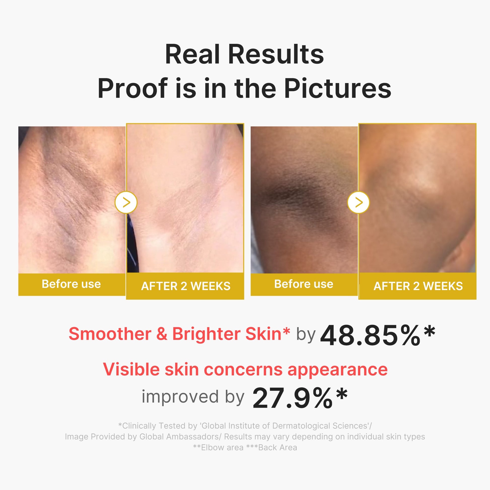 kojic-acid-turmeric-body-peel-shot-c8 02_72880cfc-382b-440b-8152-7e3dce87da2a.jpg