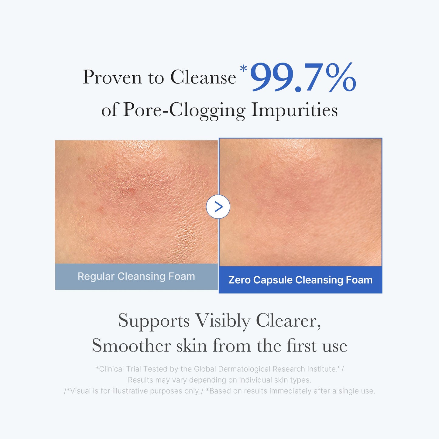zero-pore-capsule-cleansing-foam-q7 02_c1fb9dfb-86c5-4038-8ff8-490d1006276c.jpg