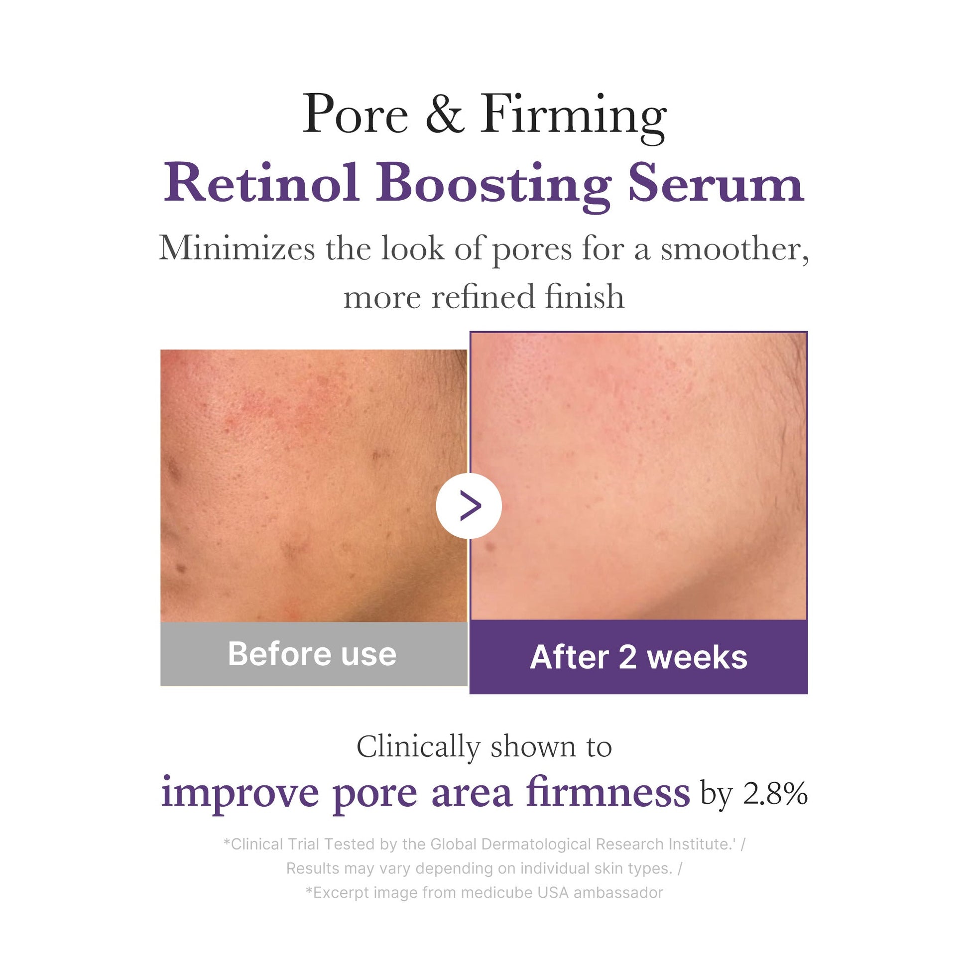 retinol-nmn-boosting-serum-a2 03_3510e7a5-5633-4a18-81ea-1389593bd517.jpg