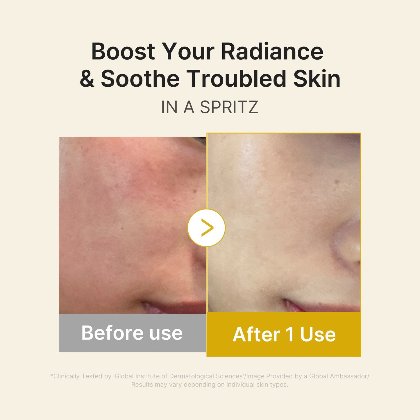 kojic-acid-turmeric-vitamin-gold-jelly-mist-serum-j0 03_dc9cd19e-4e57-49d3-9b66-c7762e8a63f1.jpg