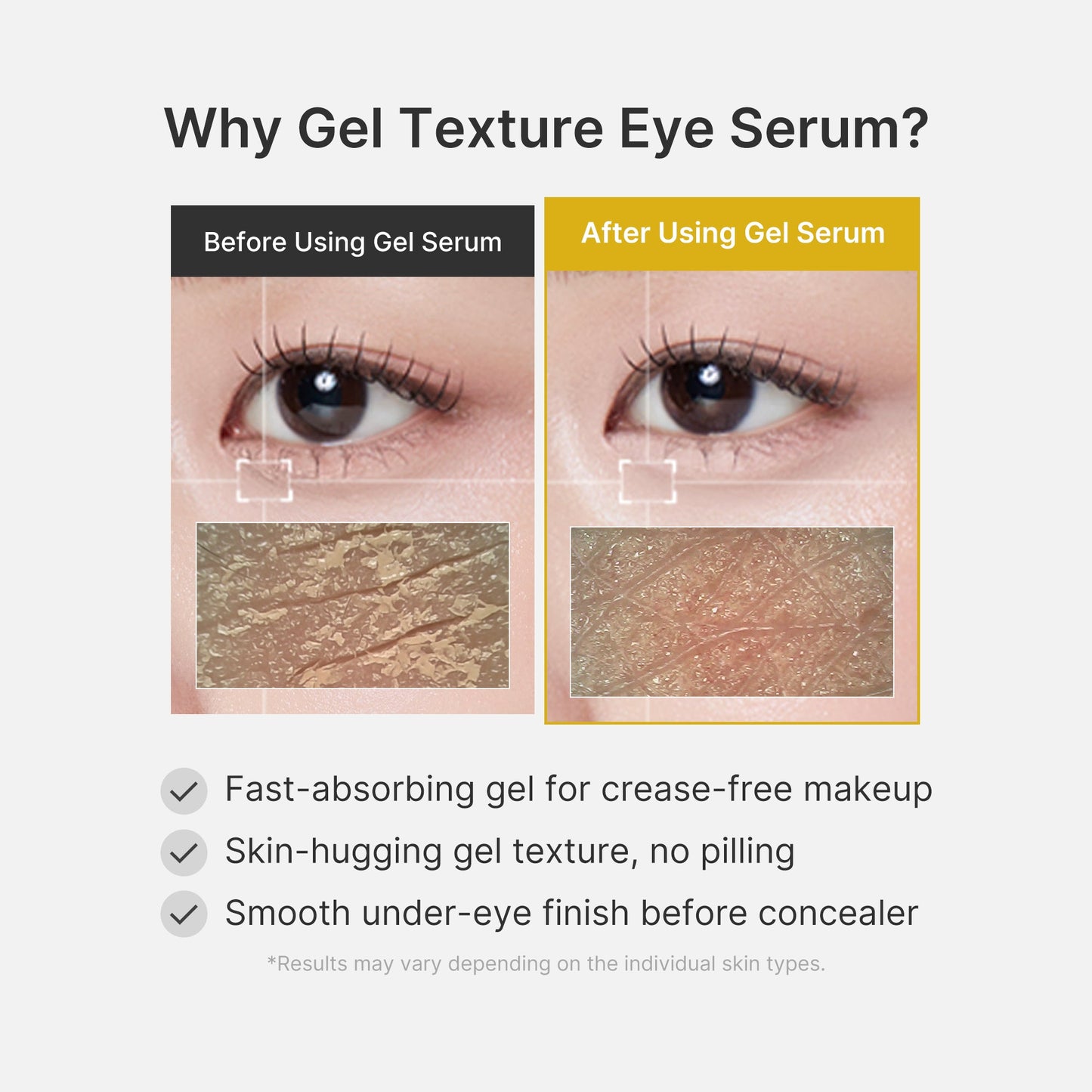 kojic-acid-tumeric-eye-gel-serum-z4 04_0487ef36-49f4-4294-8049-bb55118b05fe.jpg