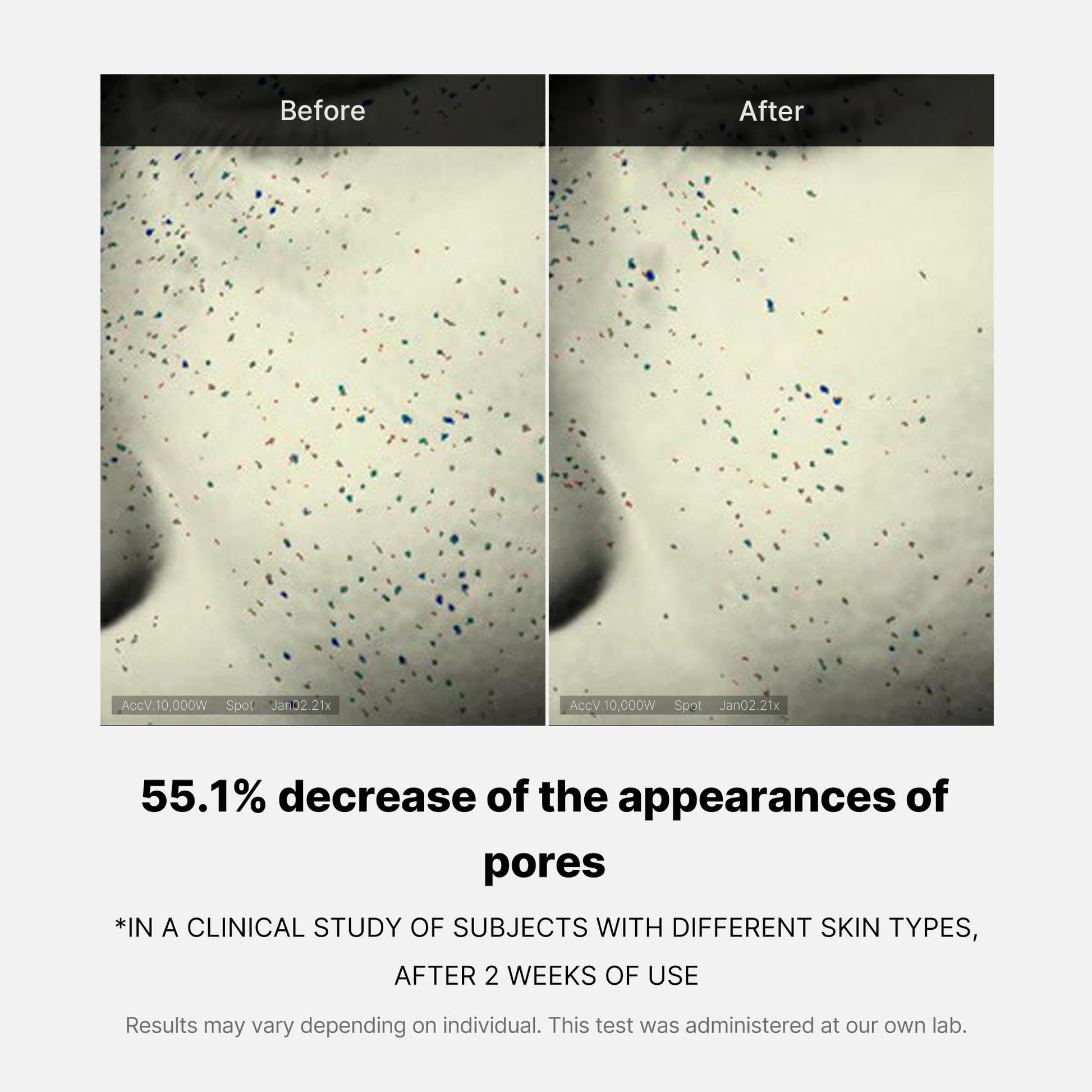 zero-pore-one-day-cream-q8 04_3616addc-f184-4deb-a5d7-e3a782e4713d.jpg