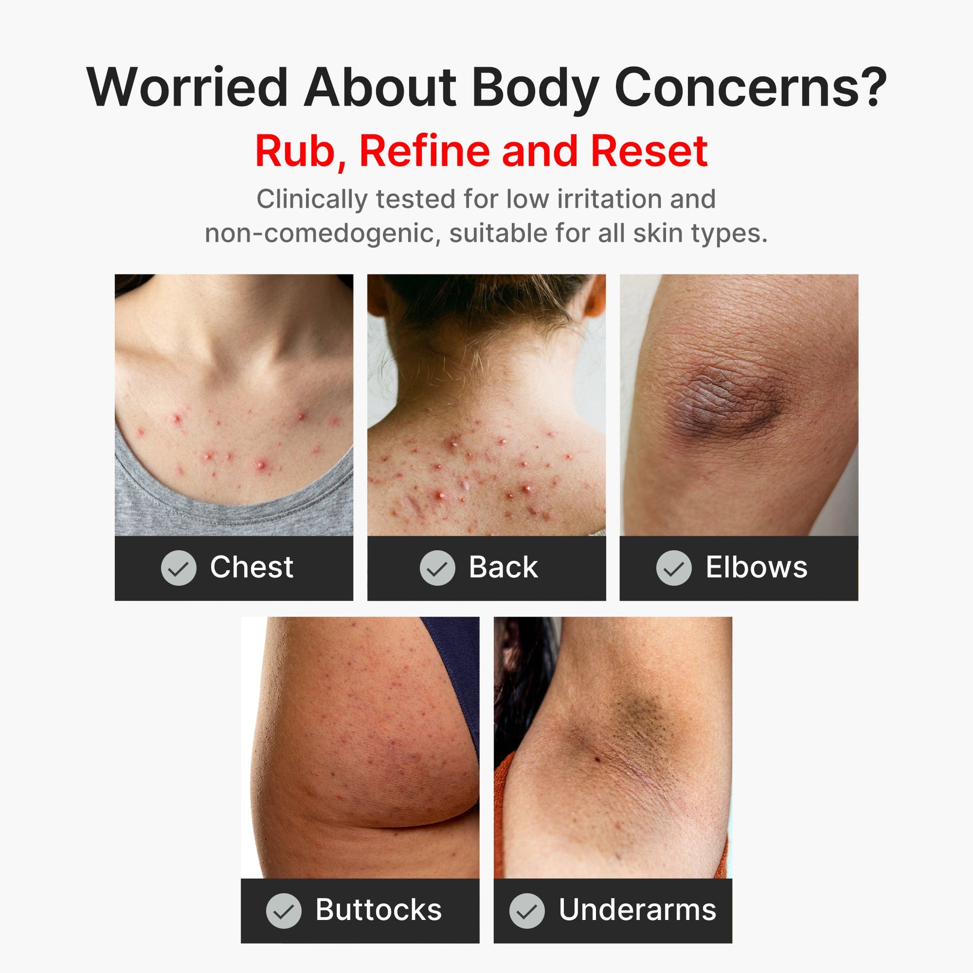 kojic-acid-turmeric-body-peel-shot-c8 04_8a7237f2-3ebf-401e-bd85-54841aeb3efc.jpg