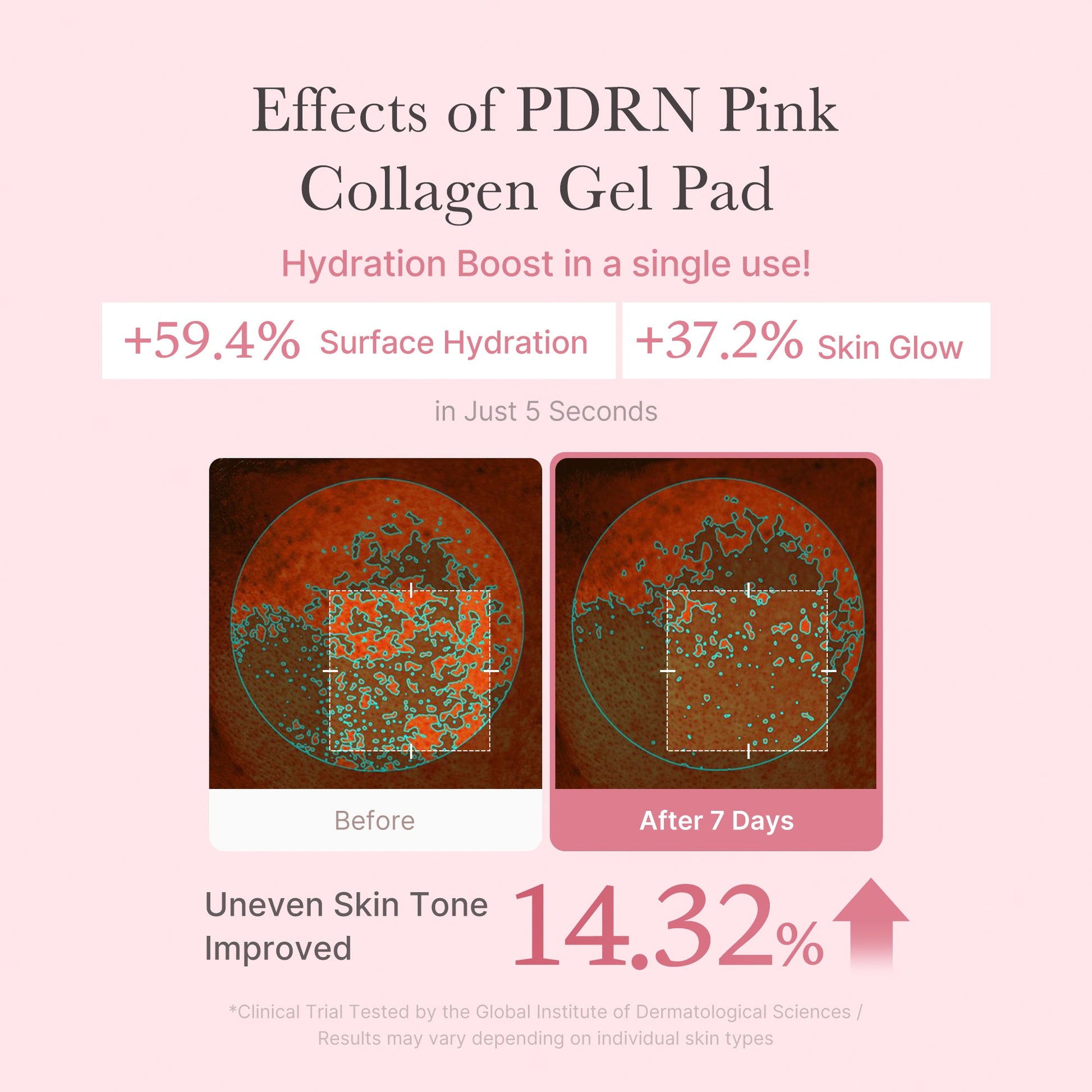 pdrn-pink-collagen-gel-toner-pad-w4 PDRN_04_f9a16a56-8d9e-4c47-a635-ed34ec3ed571.jpg