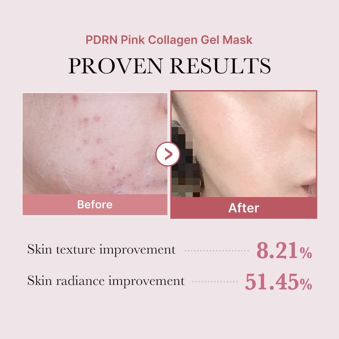 salmon-pdrn-pink-collagen-jelly-gel-mask-a7 PDRN_12.jpg